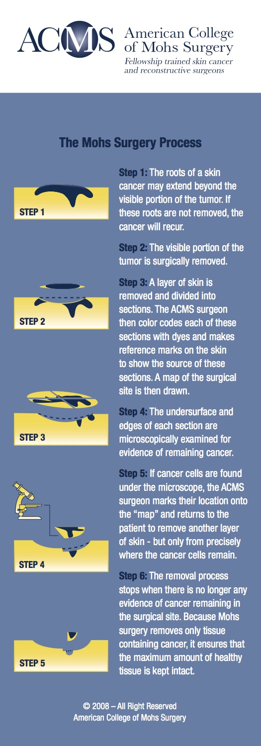 mohs surgery process